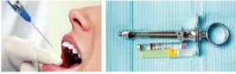 胰島素，牙科麻醉6.png